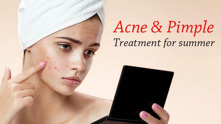 Blog 56: Acne & pimple treatment for summer - Keya Seth Aromatherapy