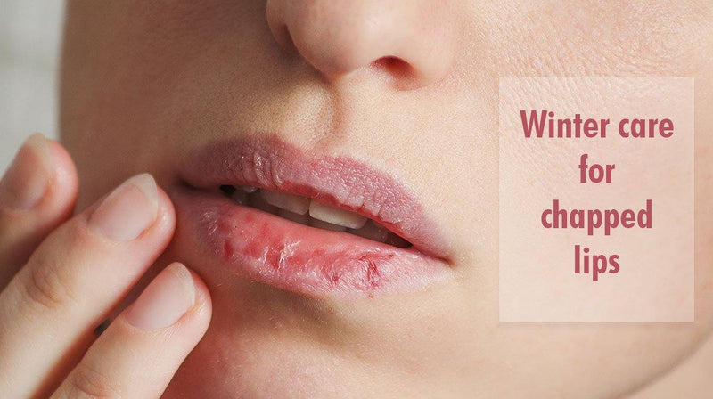 Winter Care for Chapped Lips - Keya Seth Aromatherapy