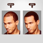 Instant Hair Brown- Hair Building Fibers for Thinning, Thickening for Fuller Hair & Hair Loss Concealer
