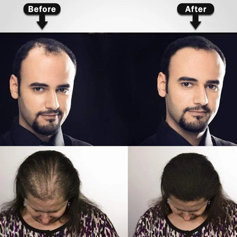 Instant Hair-Hair Building Fibers & Hair Styling Lotion for Studio Styling & Setting Combo Pack